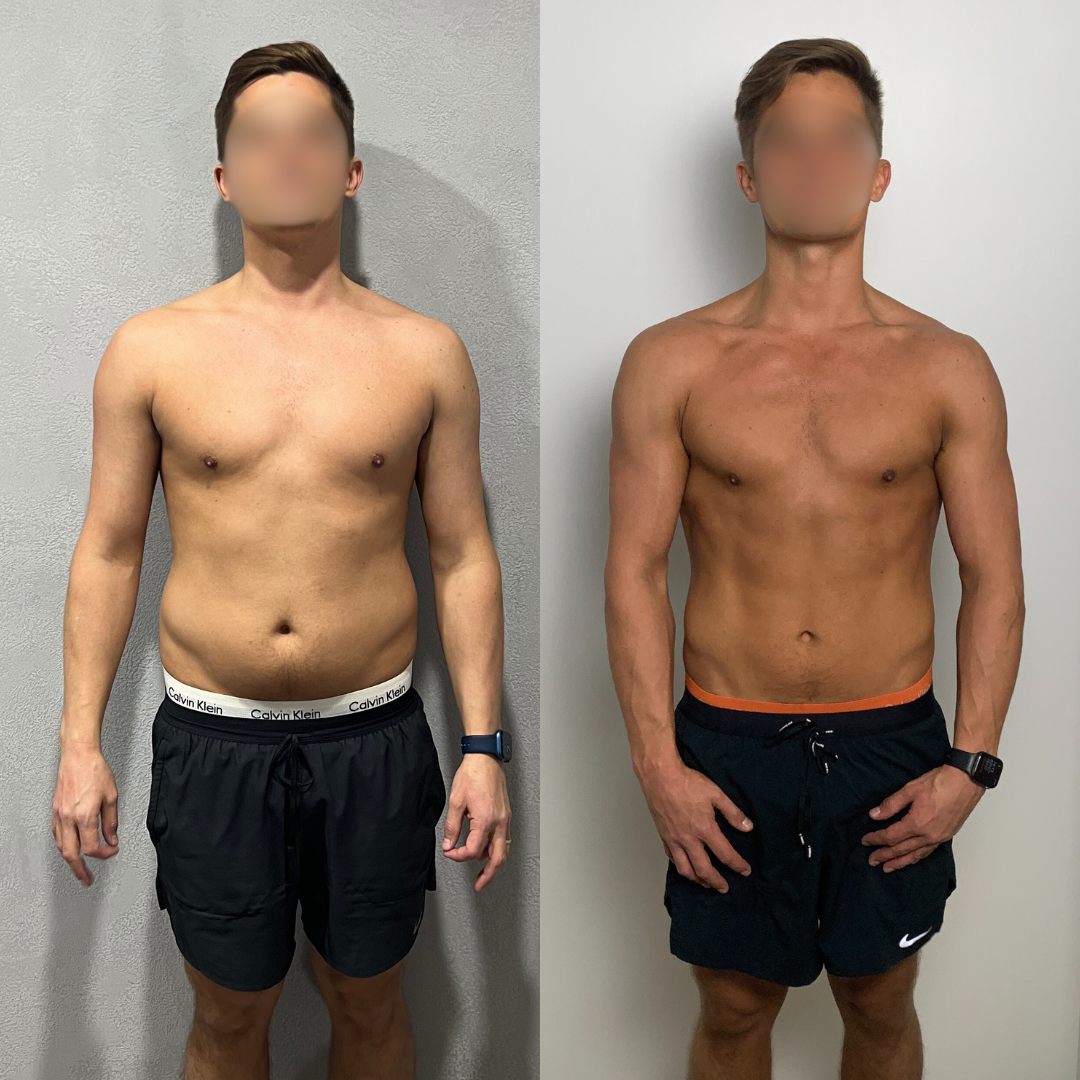 Transformation