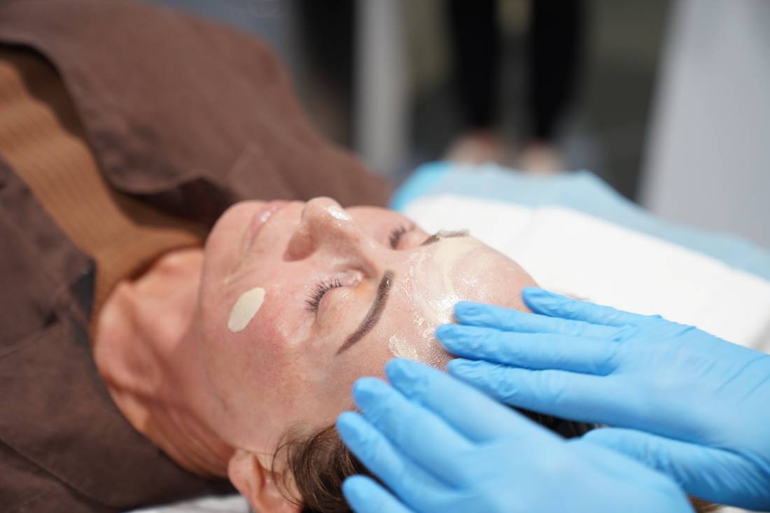 CO2 laser post treatment care at GCDC