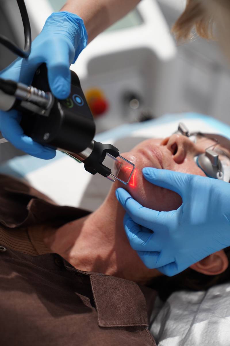 CO2 laser treatment closeup at Gold Coast Dermatology Clinic