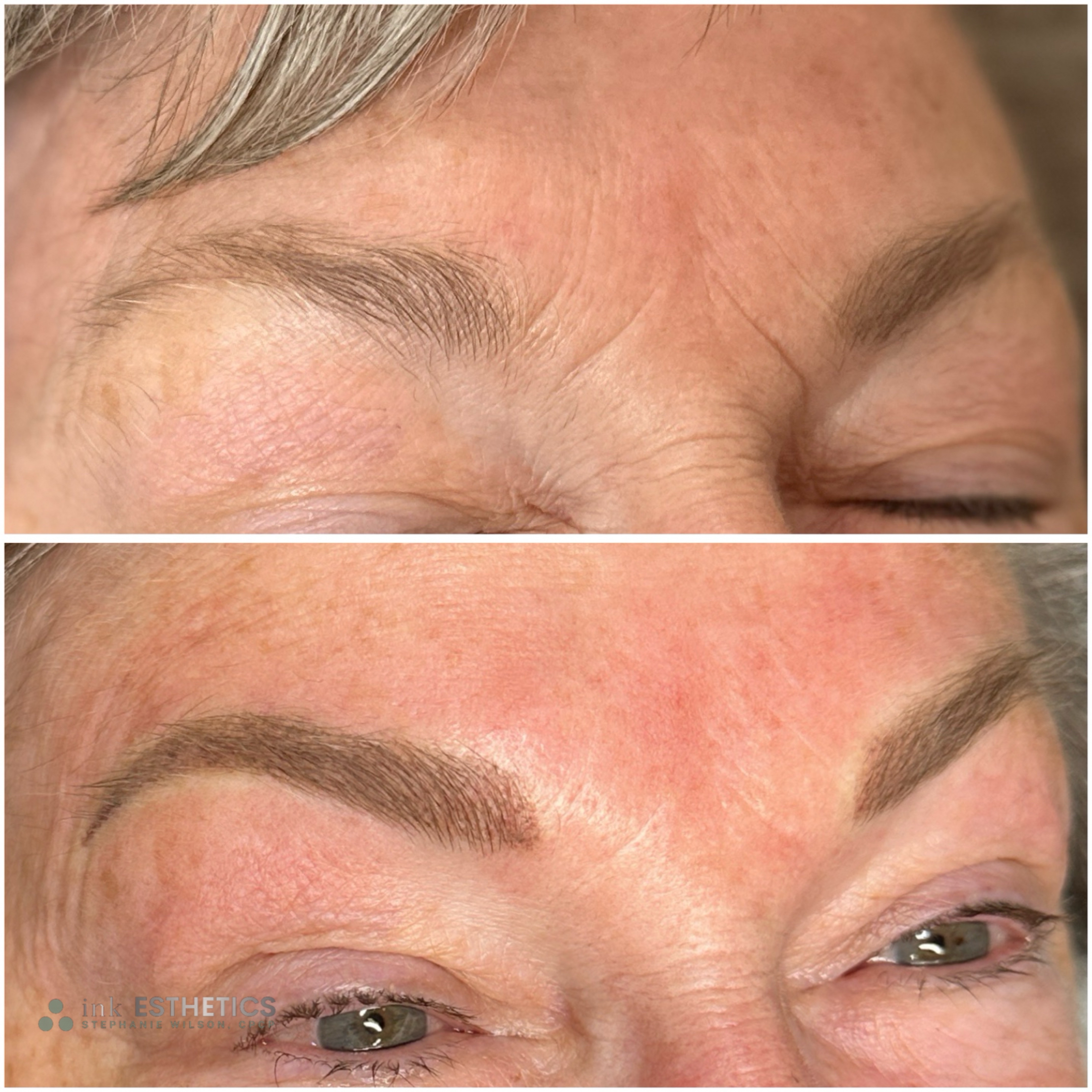 Pointillism Technique on Mature Skin Pointillism Technique on Mature Skin