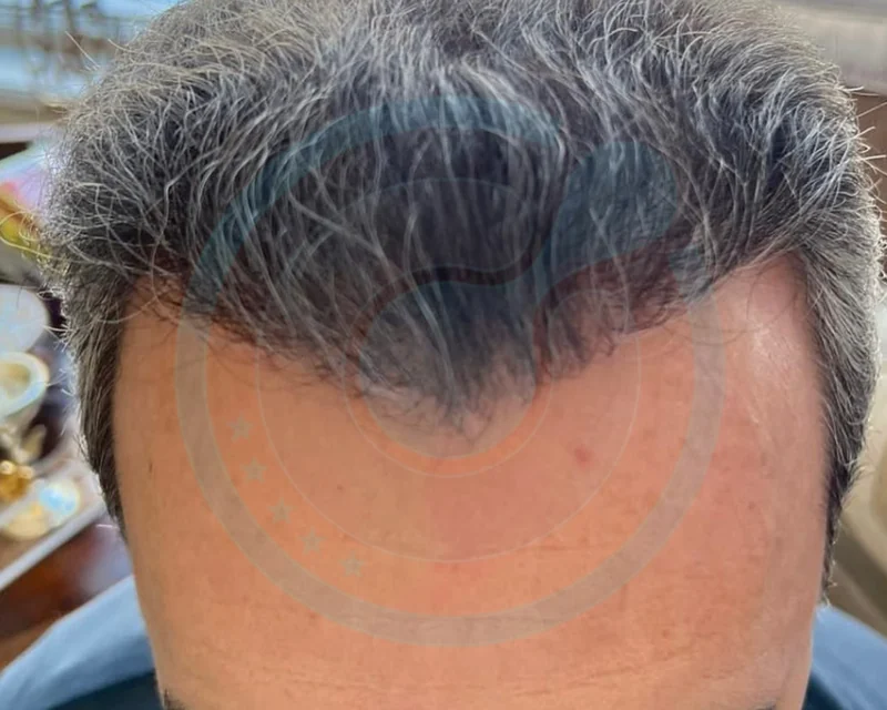 Over 50, fronte e vertice — In crescita
