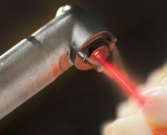 Laser dentistry