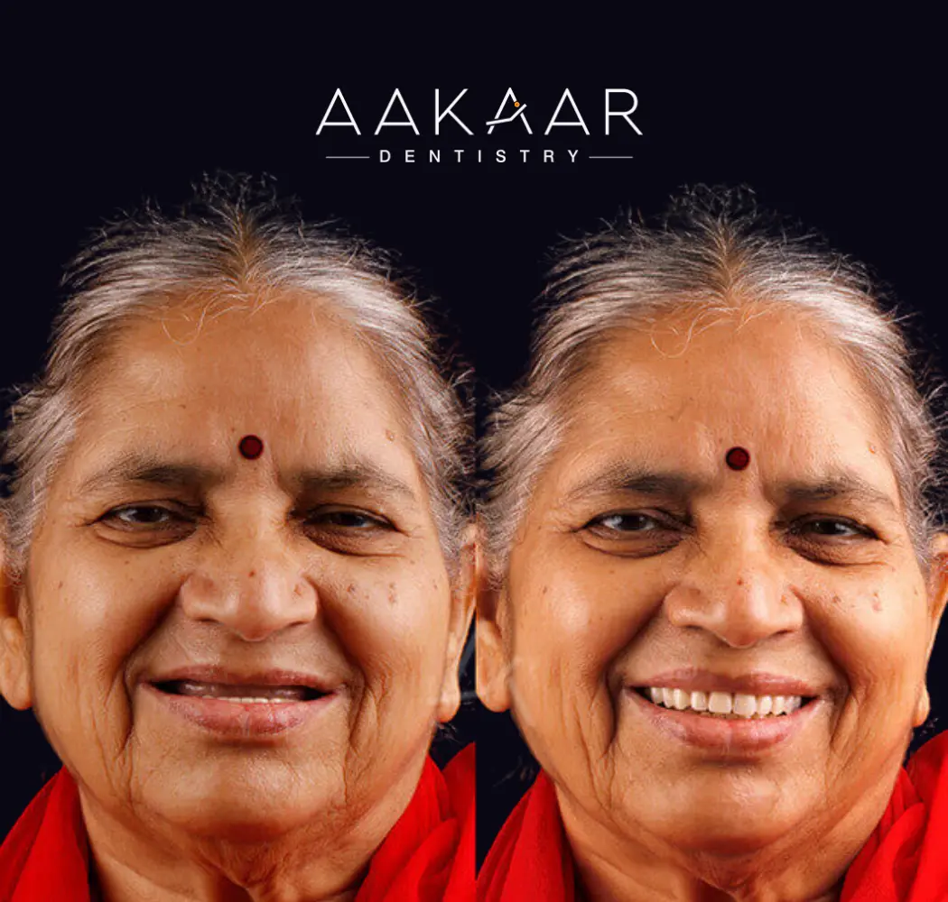 Before and after: smile restored