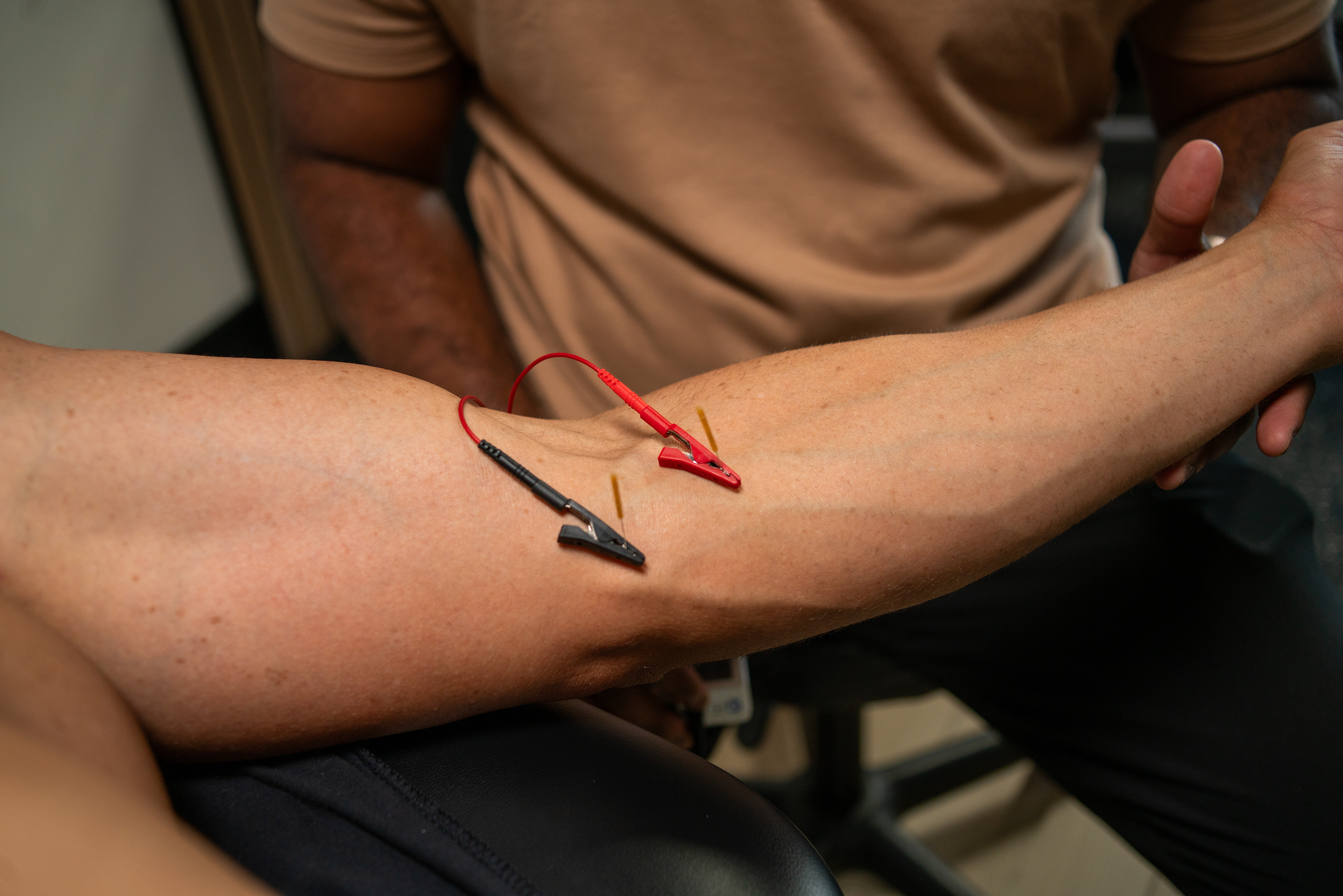 Physical therapist performing a manual therapy technique on a patient's shoulder at Revive Physiotherapy