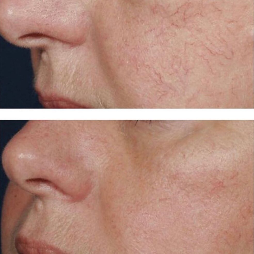 Real client before and after treatment result 36
