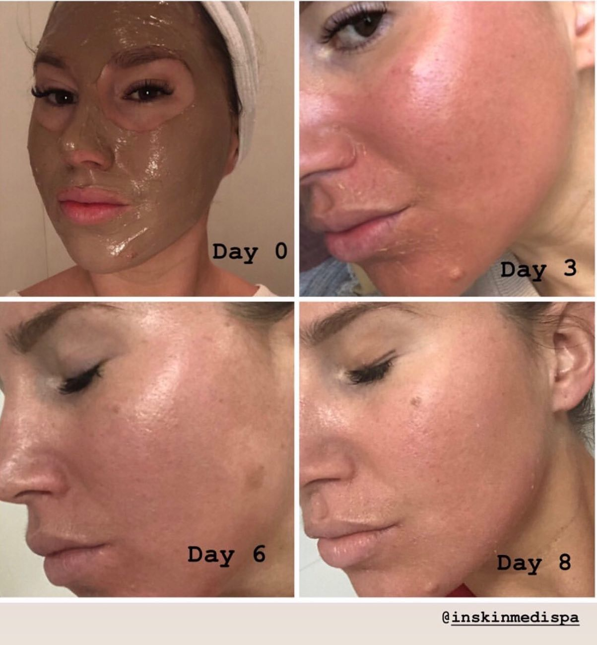 Real client before and after treatment result 28