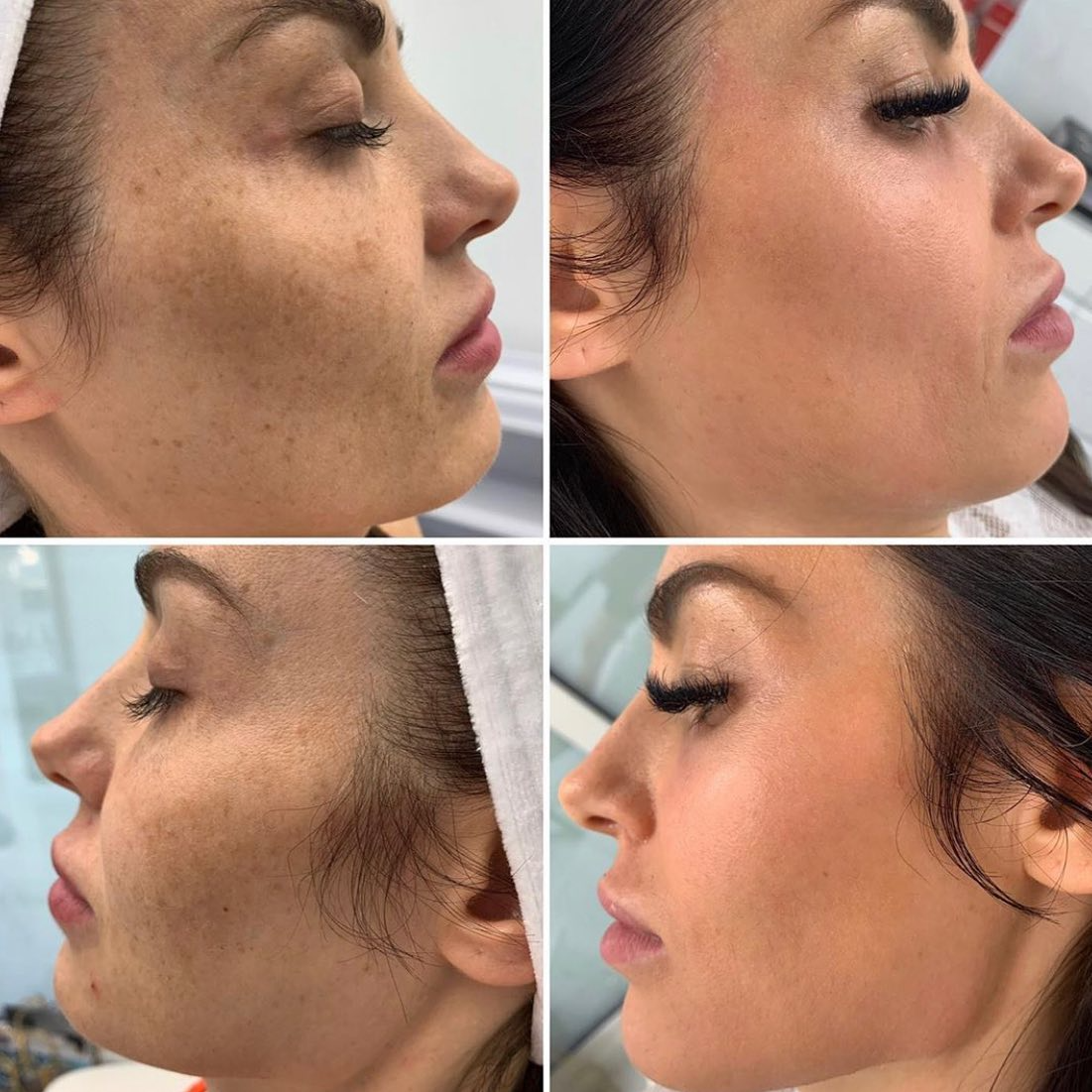Real client before and after treatment result 27
