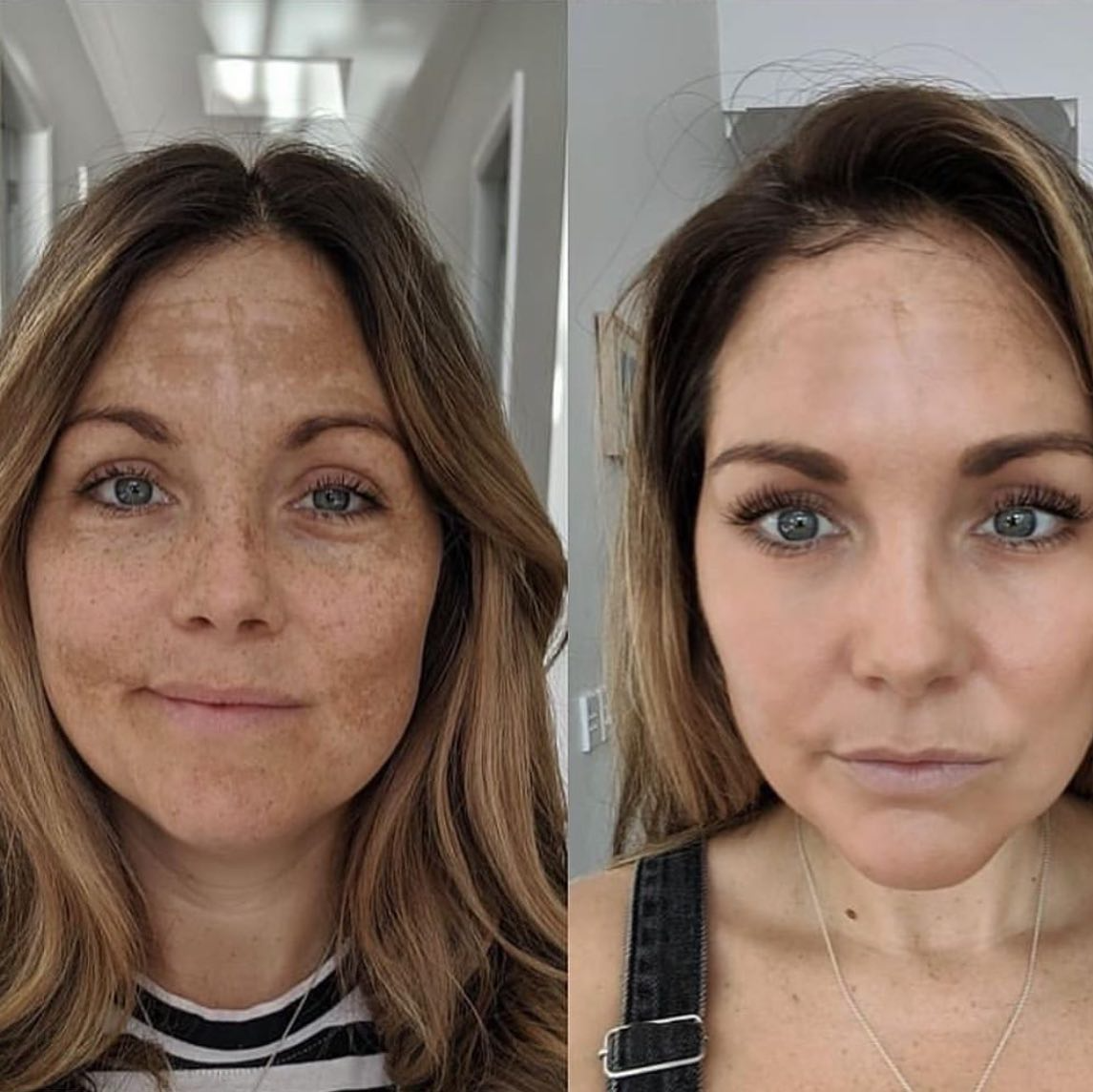 Real client before and after treatment result 24