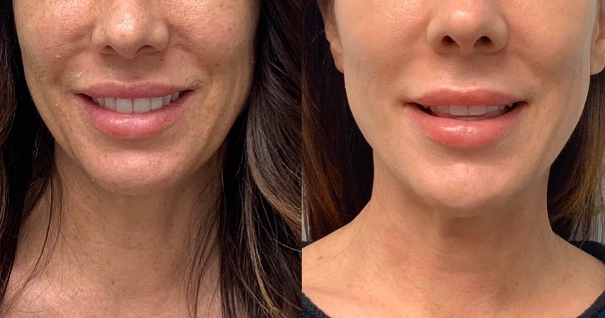 Real client before and after treatment result 21