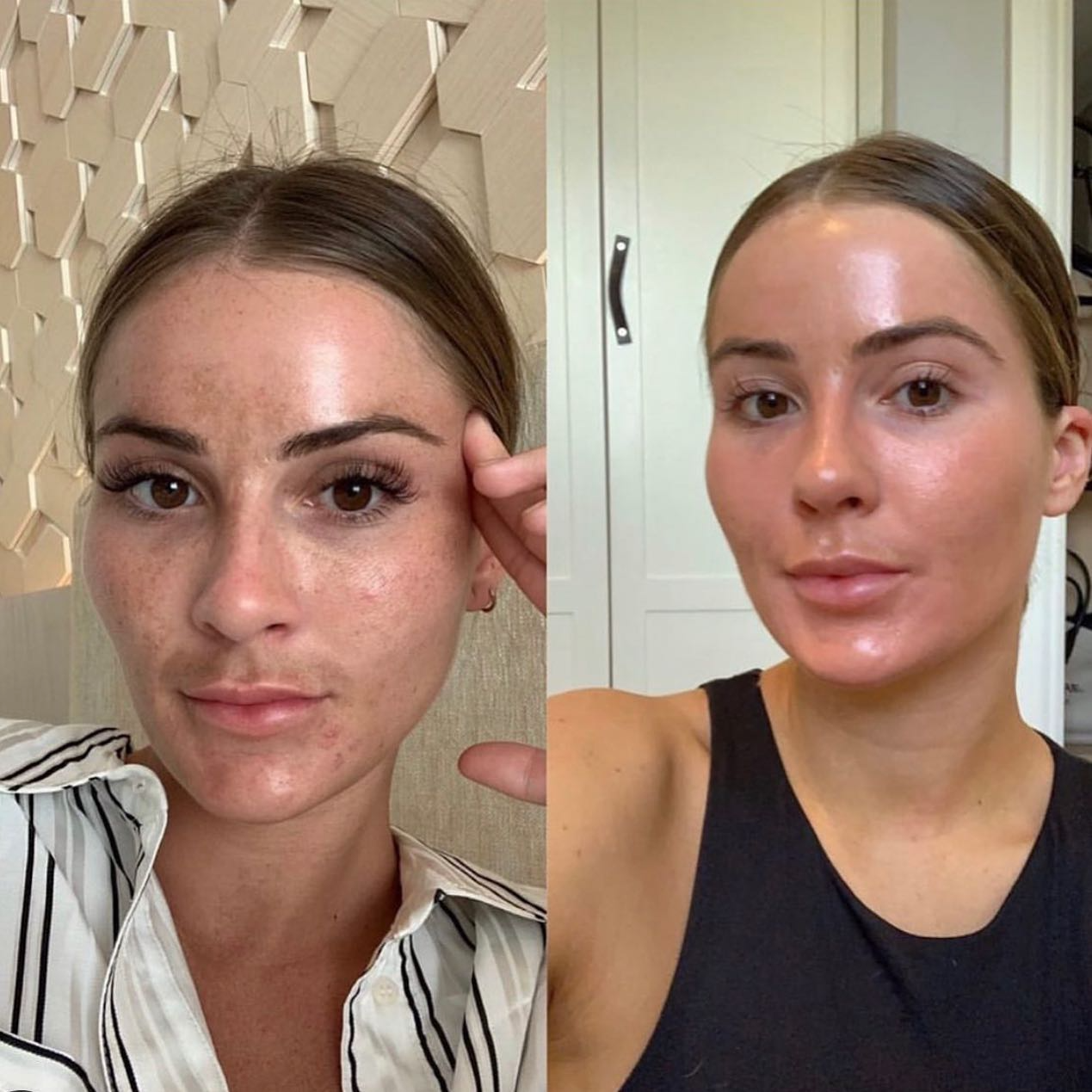 Real client before and after treatment result 19