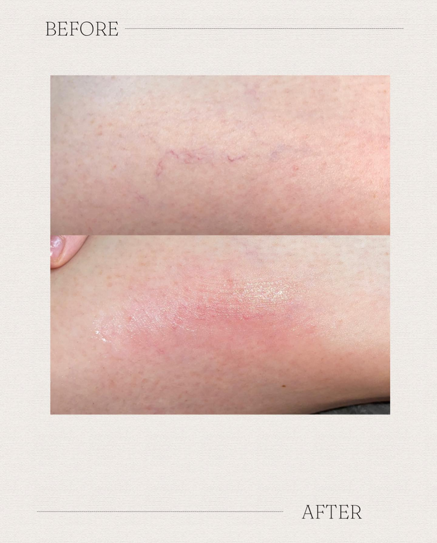 Real client before and after treatment result 16