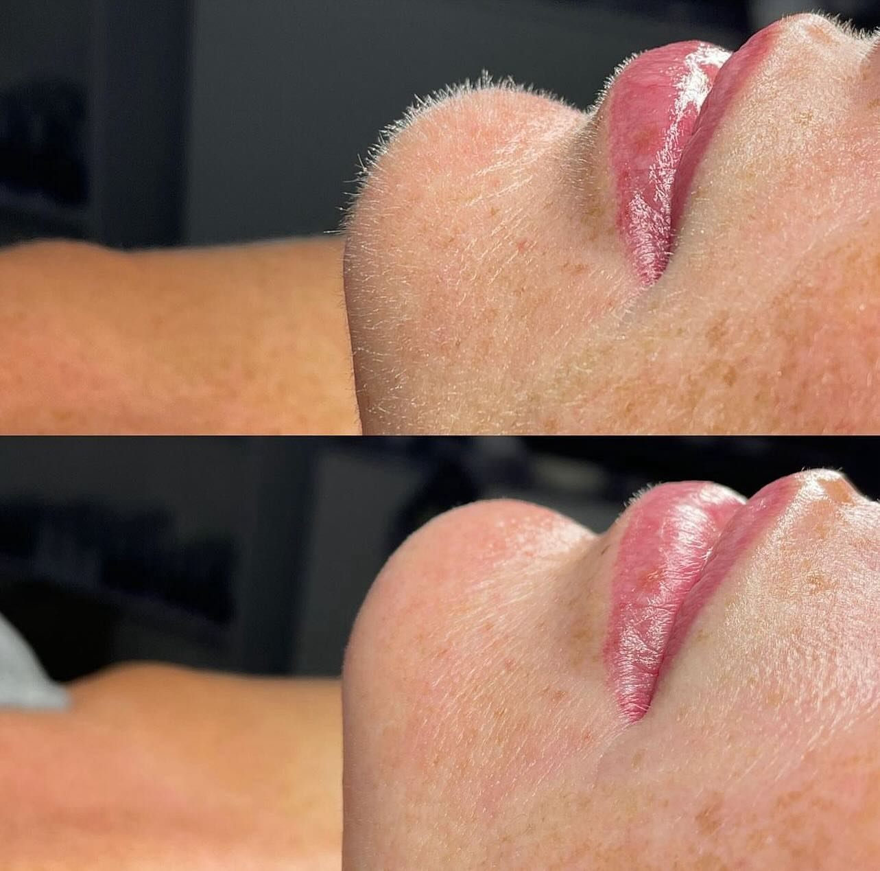 Real client before and after treatment result 13