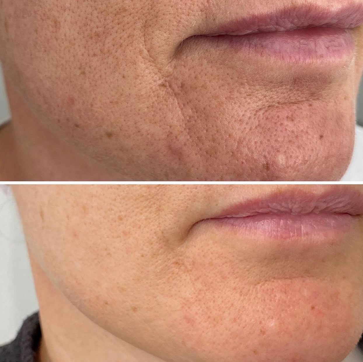 Real client before and after treatment result 17