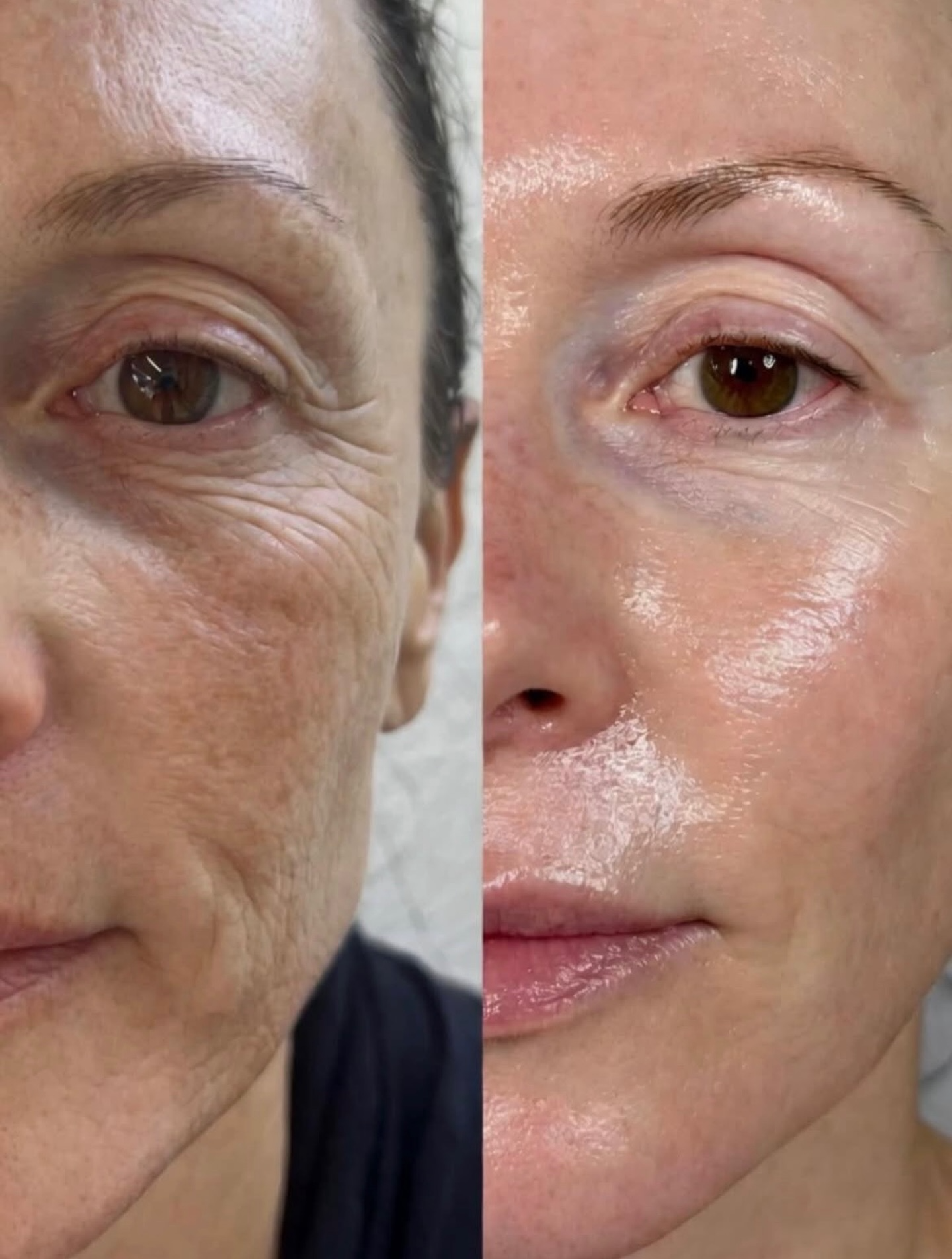 Before and after skin treatment result