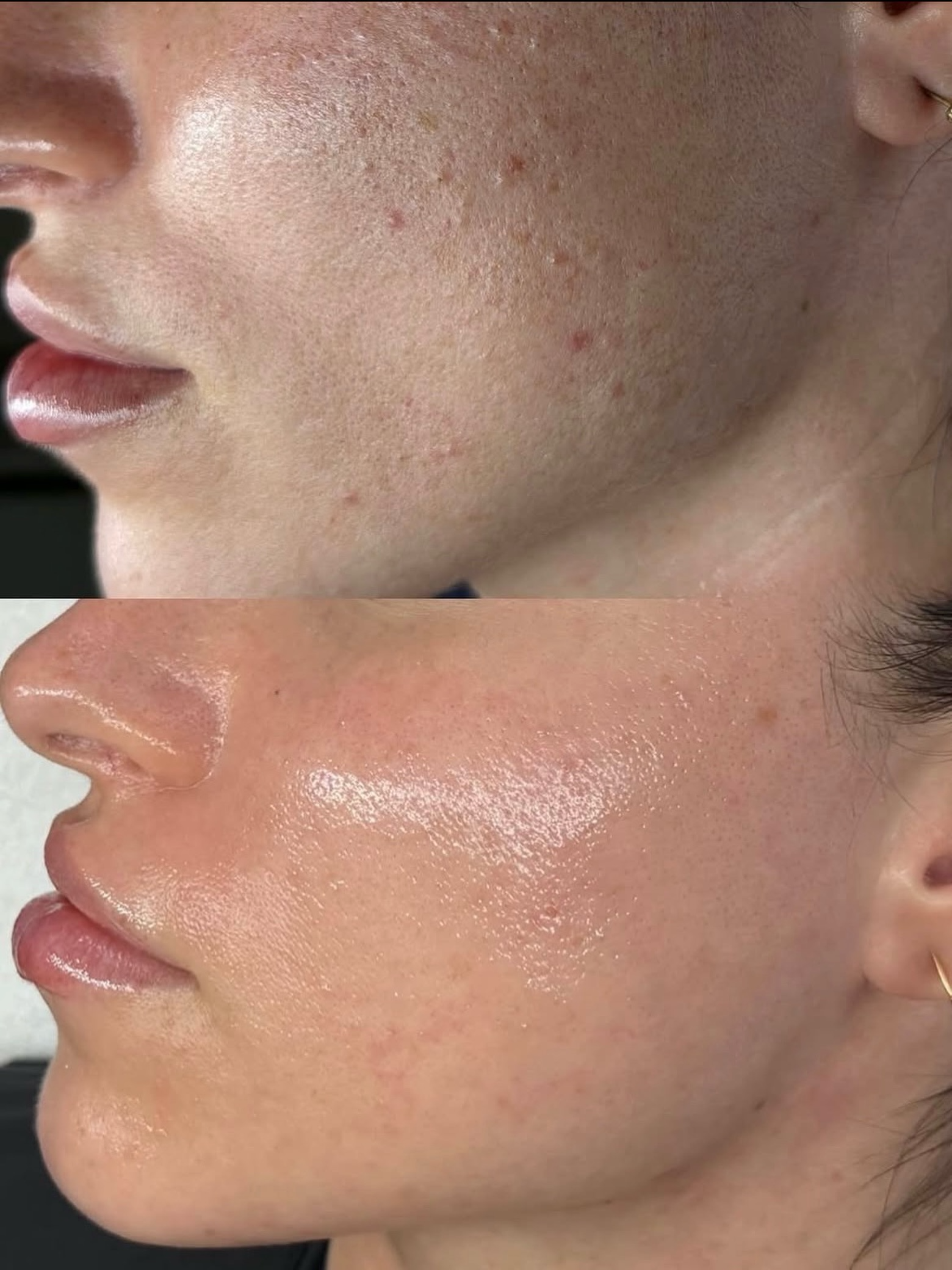 Before and after skin treatment result