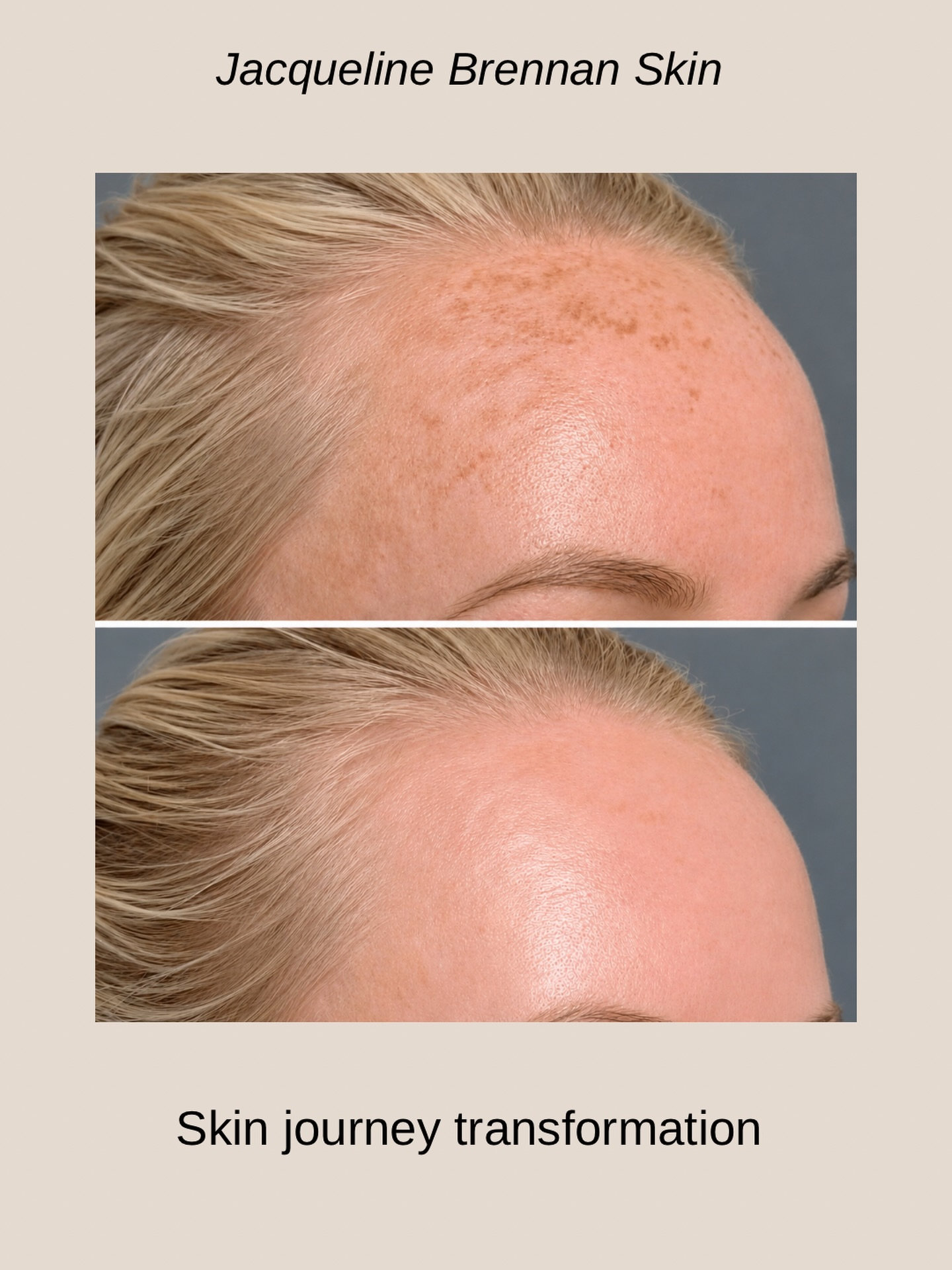 Before and after skin treatment result
