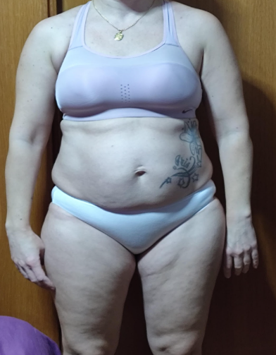 Alba frontal antes
