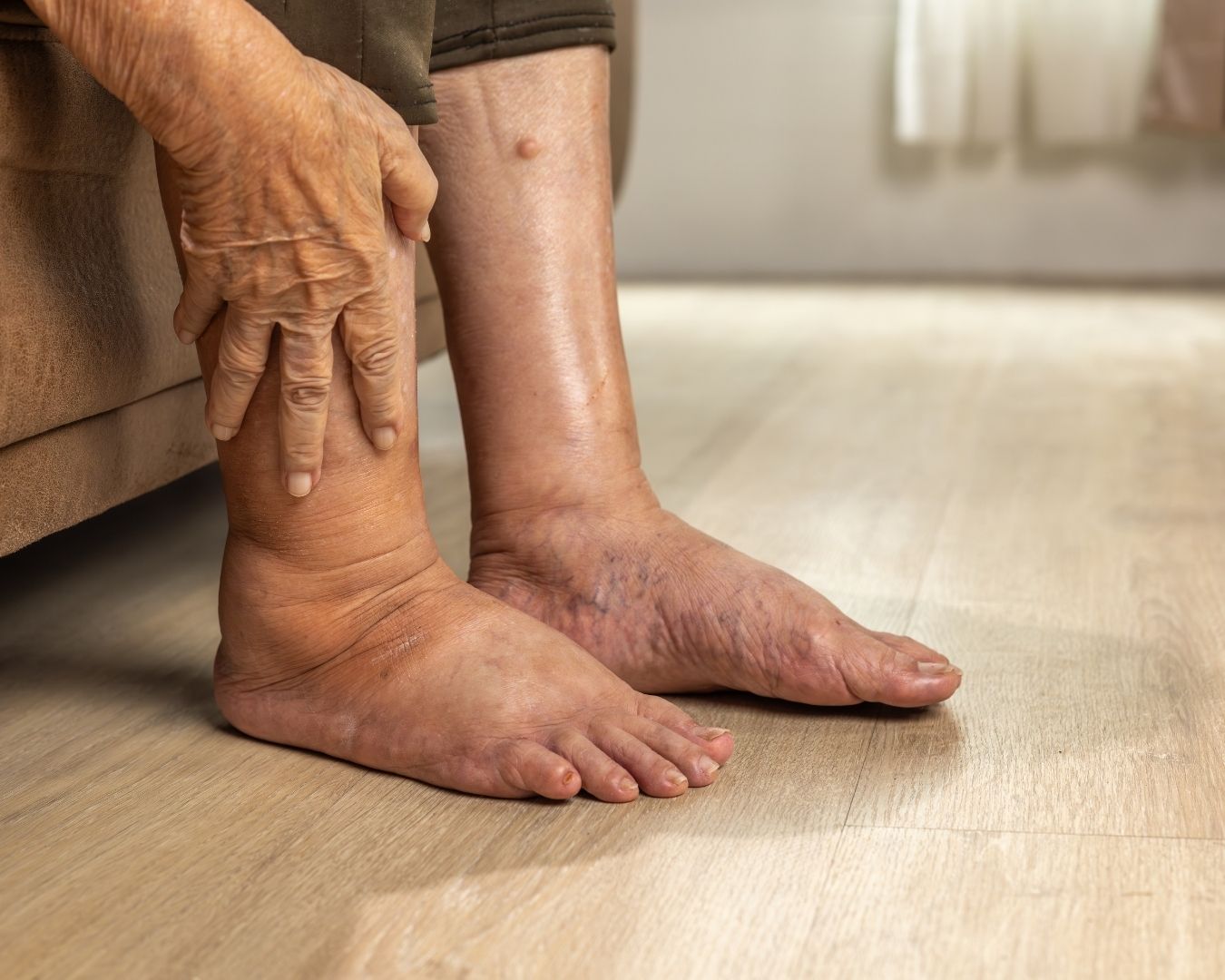 Patient performing a self-check on their lower leg for early signs of lymphedema swelling