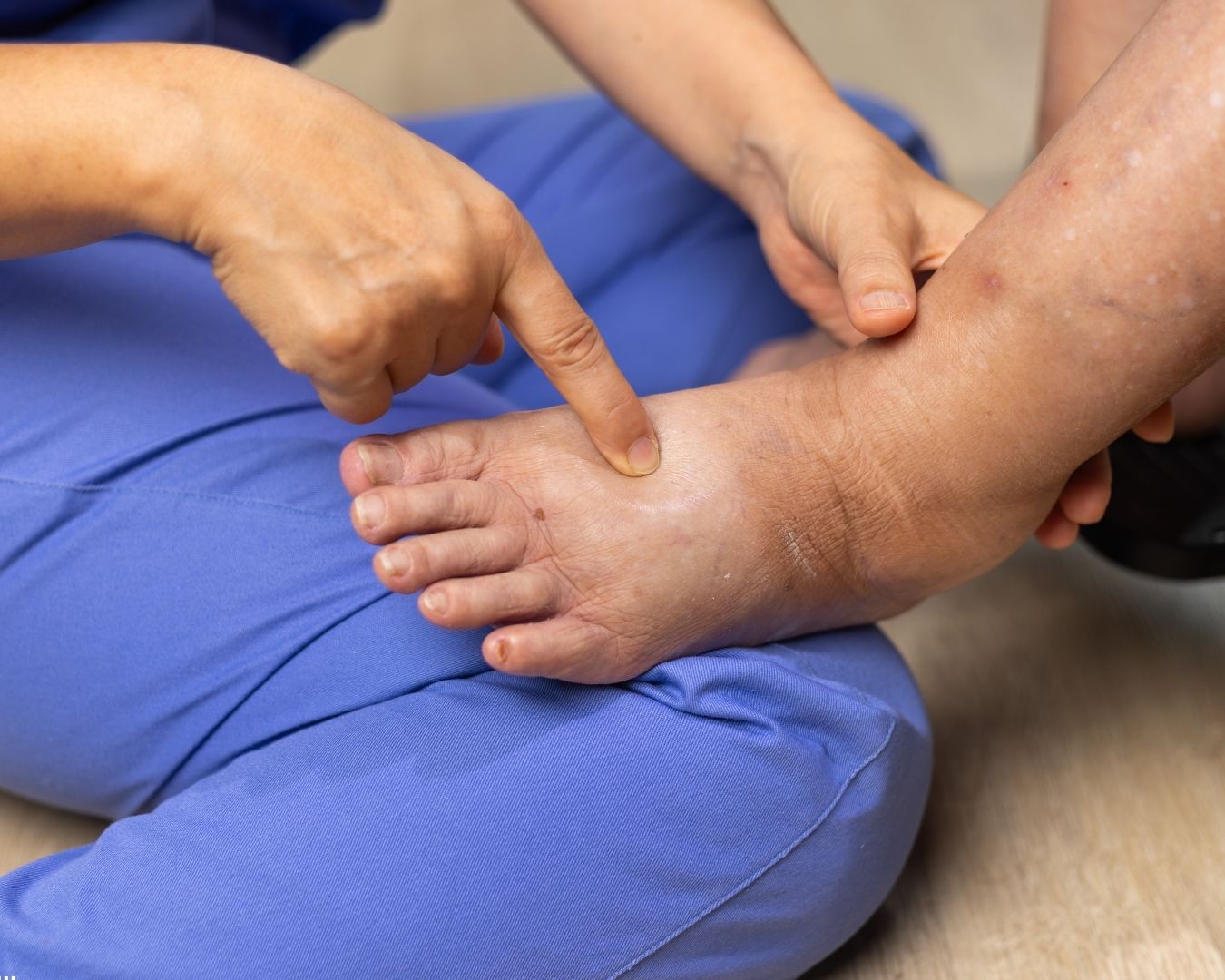 Clinician evaluating a patient with chronic lymphedema to determine whether to refer for a pneumatic compression device
