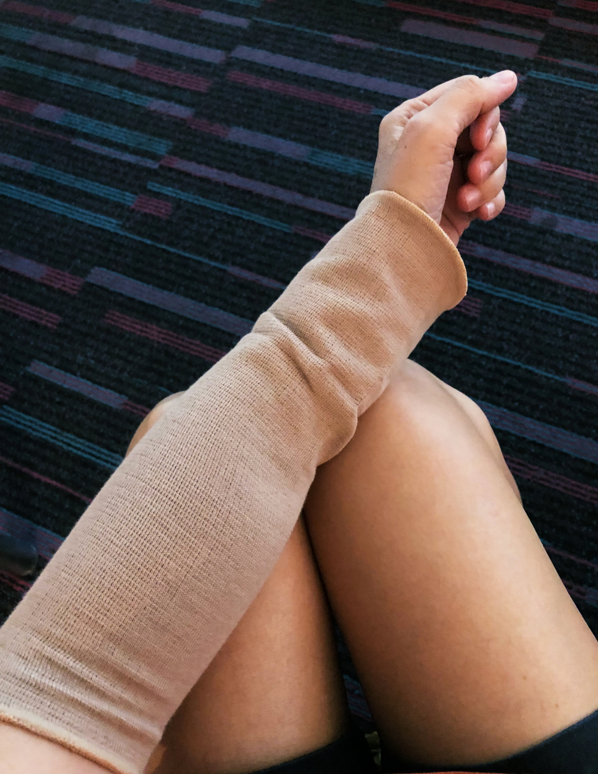 Patient wearing a graduated compression sleeve on their arm during air travel to manage lymphedema swelling