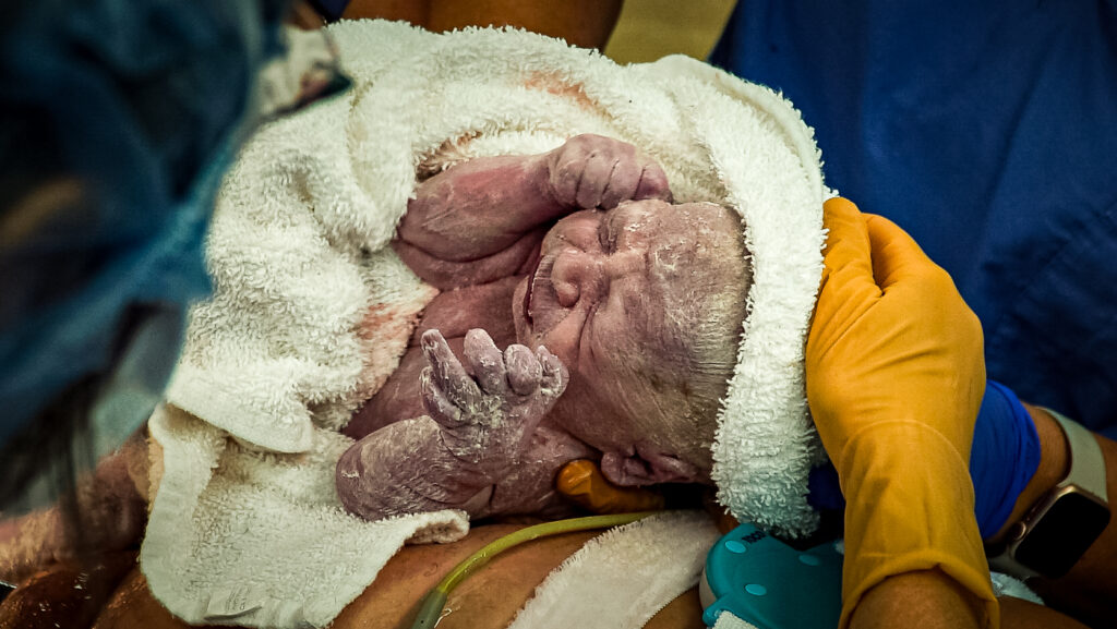 Birth photography
