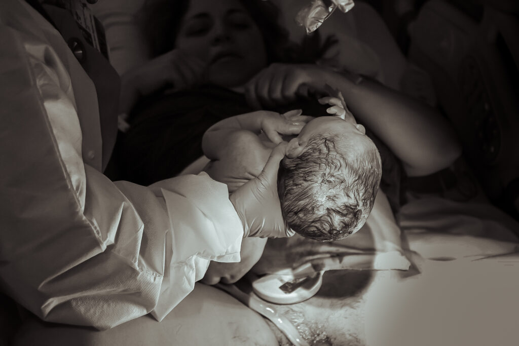 Birth photography