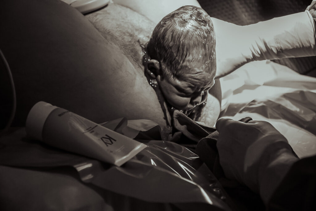Birth photography
