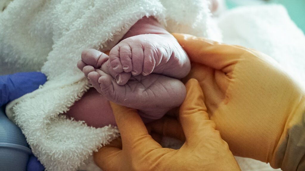 Birth photography