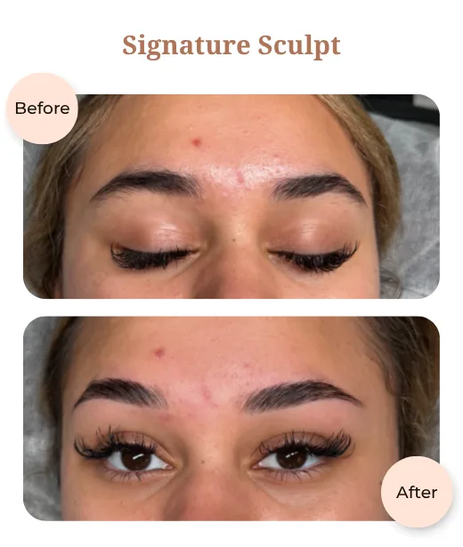 Client before and after treatment results