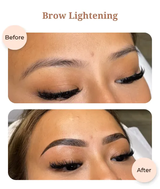 Client before and after treatment results