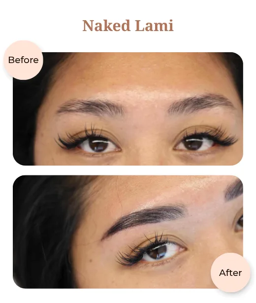 Client before and after treatment results