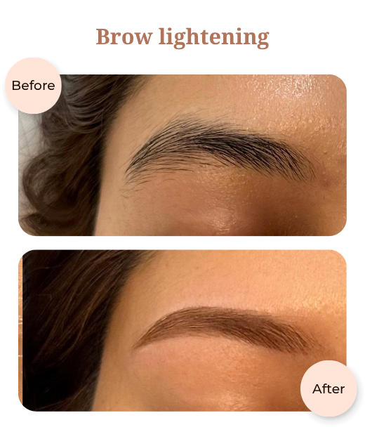 Client before and after treatment results