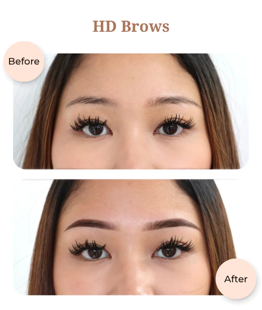 Client before and after treatment results