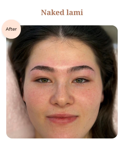 Client before and after treatment results
