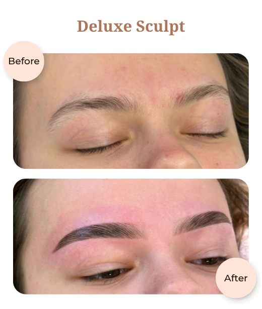 Client before and after treatment results