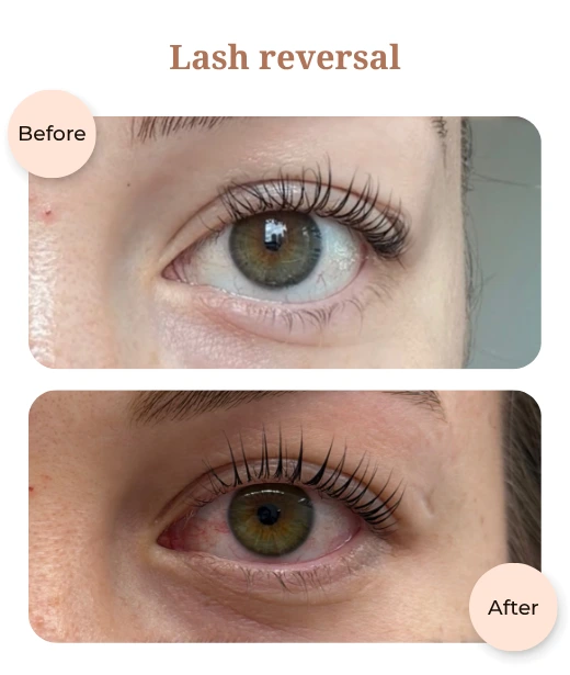 Client before and after treatment results