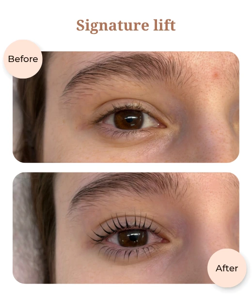 Client before and after treatment results