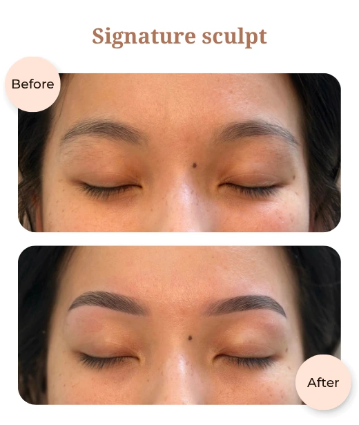 Client before and after treatment results