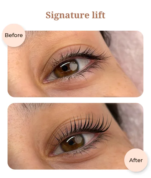 Client before and after treatment results