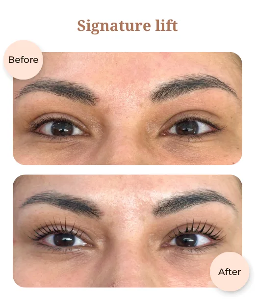 Client before and after treatment results