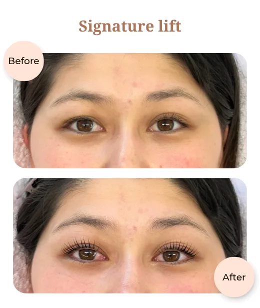 Client before and after treatment results