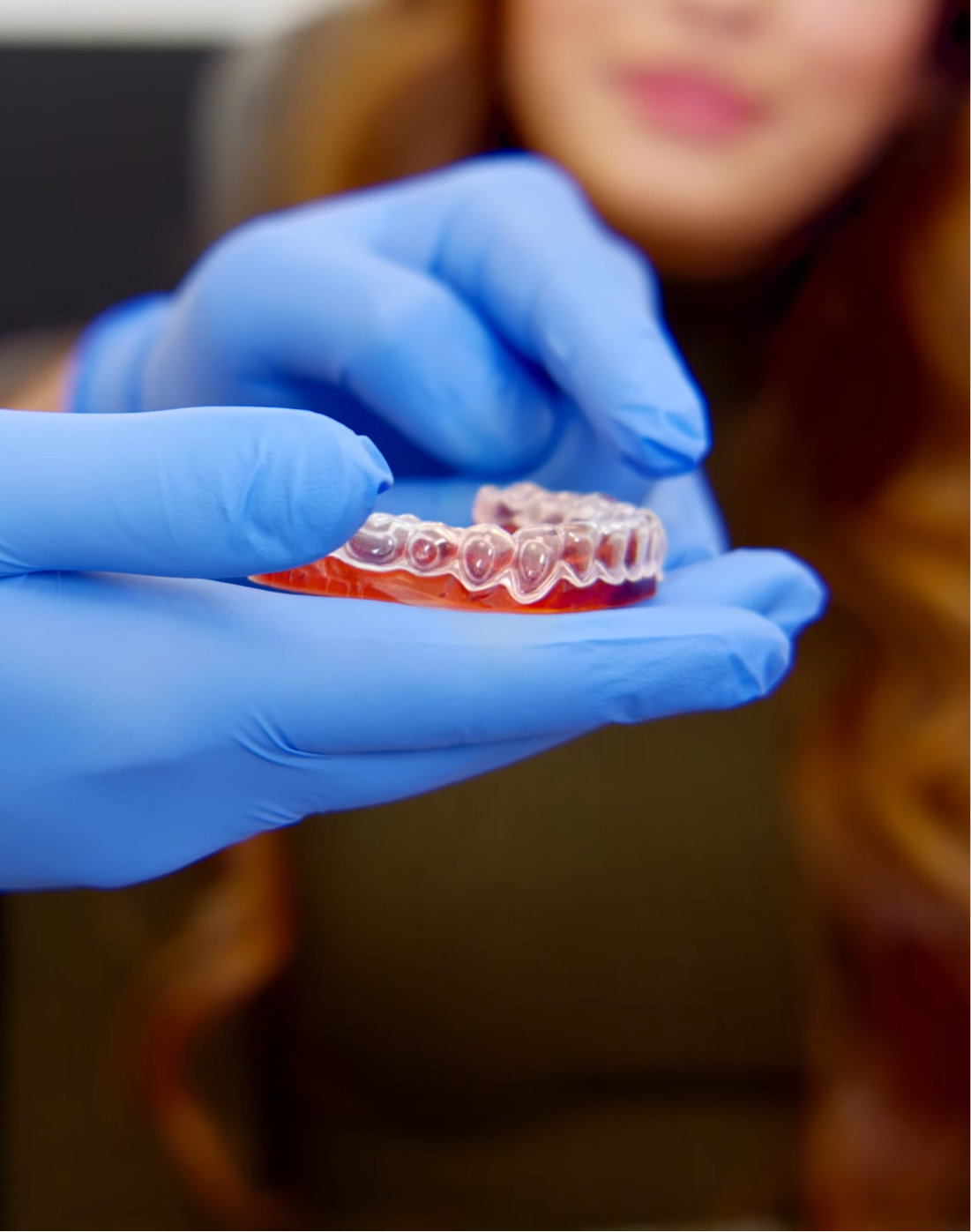Individualne belilne opornice po meri — TopDental