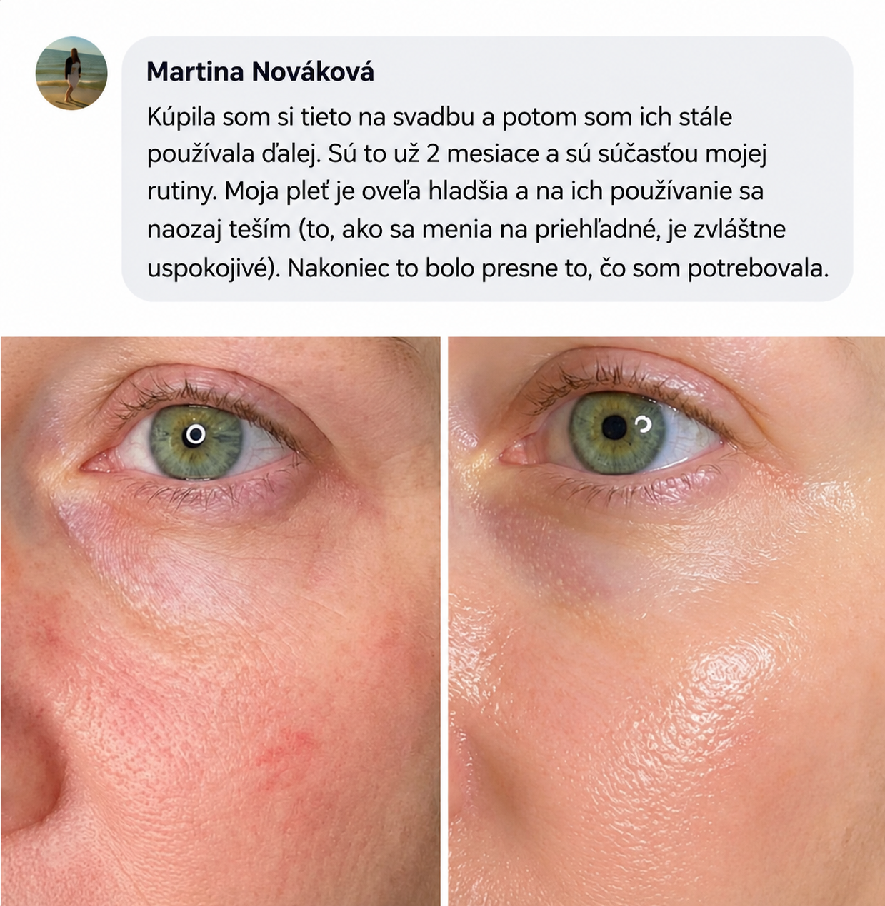 Proměna pleti 1