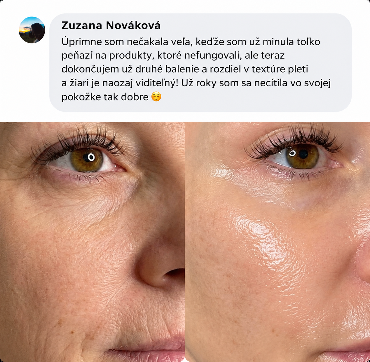 Proměna pleti 2