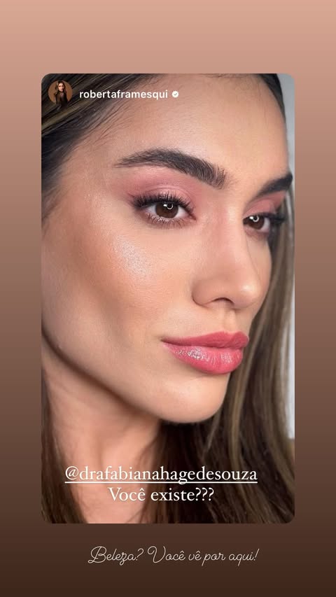 Resultado Harmonização Facial Starcliniq