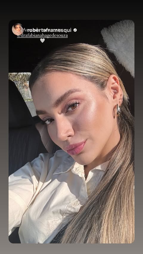 Resultado Harmonização Facial Starcliniq