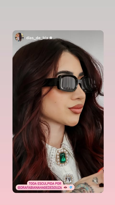 Resultado Harmonização Facial Starcliniq