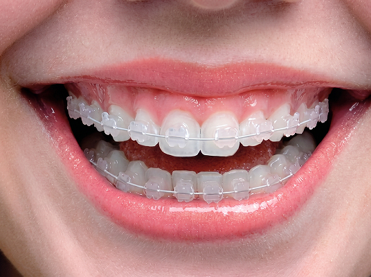 procedimento-preenchimento-labial-acido-hialuronico-araucaria-dra-fabiana-souza