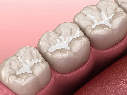 procedimento-preenchimento-labial-acido-hialuronico-araucaria-dra-fabiana-souza