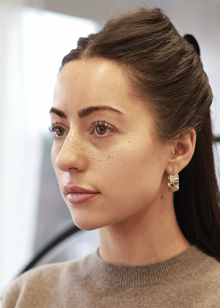 Freckles fraîchement tatouées, vue de profil